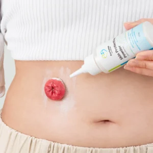 Polvo Protector para Colostomía 28g – Absorbe Humedad y Protege Piel Periestomal